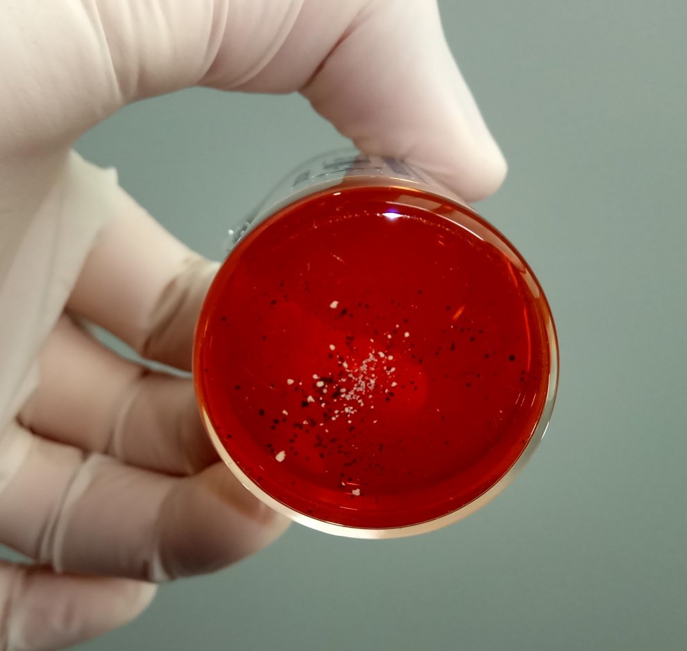 Hydra amphetamine indicates the presence of caffeine in powder 2.jpg