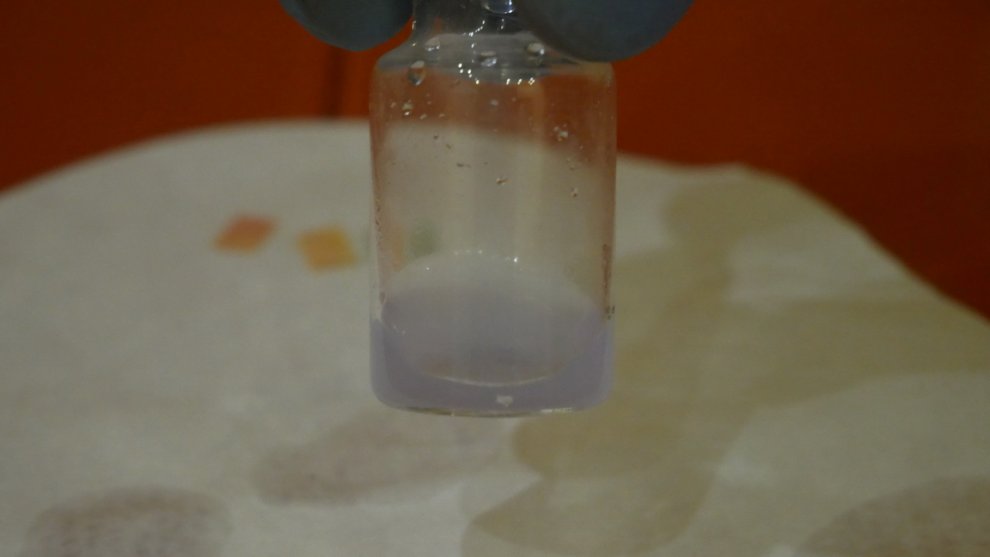 Hydra If present_ we observe a blue-violet coloration.jpg