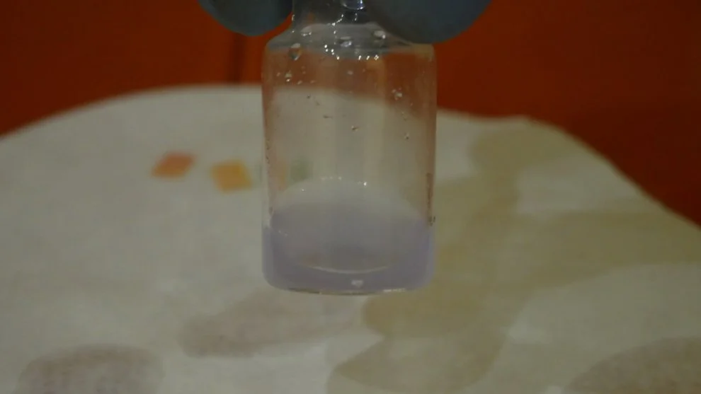 Hydra If present_ we observe a blue-violet coloration.jpg