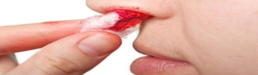 Hydra tizine_ naphthyzine and so on This should help stop the bleeding.jpg