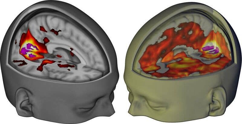 Neural connections are larger and more of them in persons taking Psychedelic.jpg